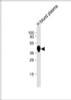 Western Blot at 1:1000 dilution + human blood plasma lysates Lysates/proteins at 20 ug per lane.