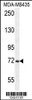 Western blot analysis in MDA-MB435 cell line lysates (35ug/lane) .