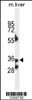 Western blot analysis in mouse liver tissue lysates (35ug/lane) .This demonstrates thedetected the B3GNT4 protein (arrow) .