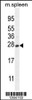 Western blot analysis in mouse spleen tissue lysates (35ug/lane) .