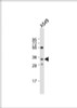 Western Blot at 1:1000 dilution + A549 whole cell lysate Lysates/proteins at 20 ug per lane.