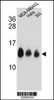 Western blot analysis in MDA-MB453, Hela, 293 cell line lysates (35ug/lane) .