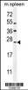 Western blot analysis in mouse spleen tissue lysates (35ug/lane) .