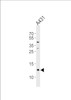 Western blot analysis of lysate from A431 cell line, using SPRR2A Antibody at 1:1000 at each lane.