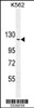 Western blot analysis in K562 cell line lysates (35ug/lane) .