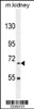 Western blot analysis in mouse kidney tissue lysates (35ug/lane) .