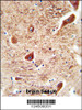 CORO7 antibody immunohistochemistry analysis in formalin fixed and paraffin embedded human brain tissue followed by peroxidase conjugation of the secondary antibody and DAB staining.