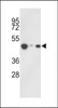 Western blot analysis of hHAT1-E404 in 293, HepG2, Jurkat cell line lysates (35ug/lane)