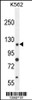 Western blot analysis in K562 cell line lysates (35ug/lane) .