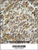 ASB17 Antibody immunohistochemistry analysis in formalin fixed and paraffin embedded human testis carcinoma followed by peroxidase conjugation of the secondary antibody and DAB staining.