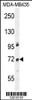 Western blot analysis in MDA-MB435 cell line lysates (35ug/lane) .