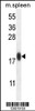 Western blot analysis in mouse spleen tissue lysates (35ug/lane) .