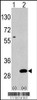 Western blot analysis of UBTD1 using rabbit polyclonal polyclonal antibody using 293 cell lysates (2 ug/lane) either nontransfected (Lane 1) or transiently transfected with the UBTD1 gene (Lane 2) .