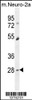 Western blot analysis in mouse Neuro-2a cell line lysates (35ug/lane) .This demonstrdetected the RP11 protein (arrow) .