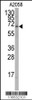 Western blot analysis of anti-RORA Antibody (T216) in A2058 cell line lysates (35ug/lane)