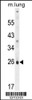 Western blot analysis in mouse lung tissue lysates (35ug/lane) .