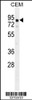 Western blot analysis in CEM cell line lysates (35ug/lane) .