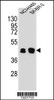 Western blot analysis in NCI-H460, SK-BR-3 cell line lysates (35ug/lane) .