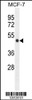 Western blot analysis in MCF-7 cell line lysates (35ug/lane) .