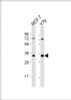 Western Blot at 1:1000 dilution Lane 1: MCF-7 whole cell lysate Lane 2: Y79 whole cell lysate Lysates/proteins at 20 ug per lane.