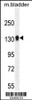 Western blot analysis in mouse bladder tissue lysates (35ug/lane) .