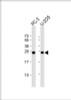 Western Blot at 1:1000 dilution Lane 1: PC-3 whole cell lysate Lane 2: U-2OS whole cell lysate Lysates/proteins at 20 ug per lane.