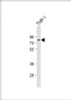 Western Blot at 1:1000 dilution + THP-1 whole cell lysate Lysates/proteins at 20 ug per lane.