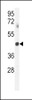 Western blot analysis in mouse spleen tissue lysates (35ug/lane) .