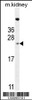 Western blot analysis in mouse kidney tissue lysates (35ug/lane) .