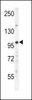 Western blot analysis in mouse lung tissue lysates (35ug/lane) .