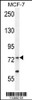 Western blot analysis in MCF-7 cell line lysates (35ug/lane) .