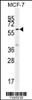 Western blot analysis in MCF-7 cell line lysates (35ug/lane) .