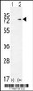 Western blot analysis of KARS using rabbit polyclonal KARS Antibody using 293 cell lysates (2 ug/lane) either nontransfected (Lane 1) or transiently transfected (Lane 2) with the KARS gene.