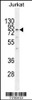 Western blot analysis in Jurkat cell line lysates (35ug/lane) .