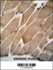 ELMO2 Antibody immunohistochemistry analysis in formalin fixed and paraffin embedded human skeletal muscle followed by peroxidase conjugation of the secondary antibody and DAB staining.
