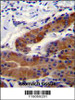 DFNB31 Antibody immunohistochemistry analysis in formalin fixed and paraffin embedded stomach tissue followed by peroxidase conjugation of the secondary antibody and DAB staining.