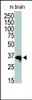 Antibody is used in Western blot to detect HDAC11 in mouse brain tissue lysate.