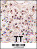 Formalin-fixed and paraffin-embedded human testicle tumor tissue reacted with HDAC11 antibody, which was peroxidase-conjugated to the secondary antibody, followed by DAB staining.