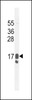 Western blot analysis in MDA-MB231 cell line lysates (35ug/lane) .