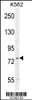 Western blot analysis in K562 cell line lysates (35ug/lane) .