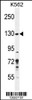 Western blot analysis in K562 cell line lysates (35ug/lane) .