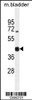 Western blot analysis in mouse bladder tissue lysates (35ug/lane) .