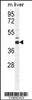 Western blot analysis in mouse liver tissue lysates (35ug/lane) .