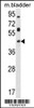 Western blot analysis in mouse bladder tissue lysates (35ug/lane) .