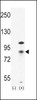 Western blot analysis of CTNB1 using rabbit polyclonal CTNB1 Antibody using 293 cell lysates (2 ug/lane) either nontransfected (Lane 1) or transiently transfected (Lane 2) with the CTNB1 gene.