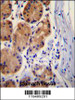 CTNB1 Antibody immunohistochemistry analysis in formalin fixed and paraffin embedded human stomach tissue followed by peroxidase conjugation of the secondary antibody and DAB staining.