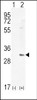 Western blot analysis of HMOX1 using rabbit polyclonal HMOX1 Antibody using 293 cell lysates (2 ug/lane) either nontransfected (Lane 1) or transiently transfected (Lane 2) with the HMOX1 gene.