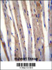 KRT73 Antibody immunohistochemistry analysis in formalin fixed and paraffin embedded m.heart tissue followed by peroxidase conjugation of the secondary antibody and DAB staining.