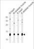 Western blot analysis in mouse heart, skeletal muscle and rat heart, skeletal muscle tissue lysates (35ug/lane) .This demonstrates the PLM antibody detected the PLM protein (arrow) .