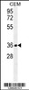 Western blot analysis in CEM cell line lysates (35ug/lane) .